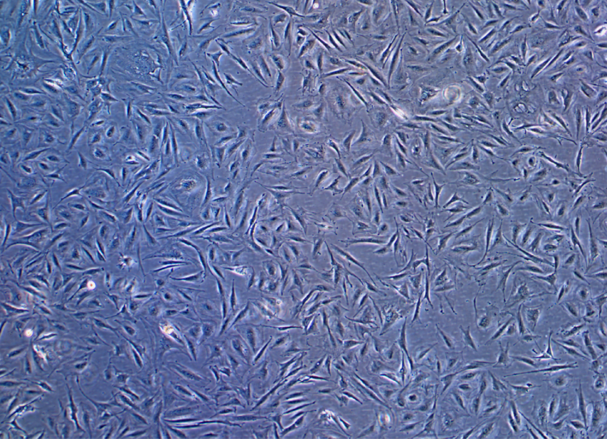 人膽管癌細胞HuH28(STR鑒定正確)