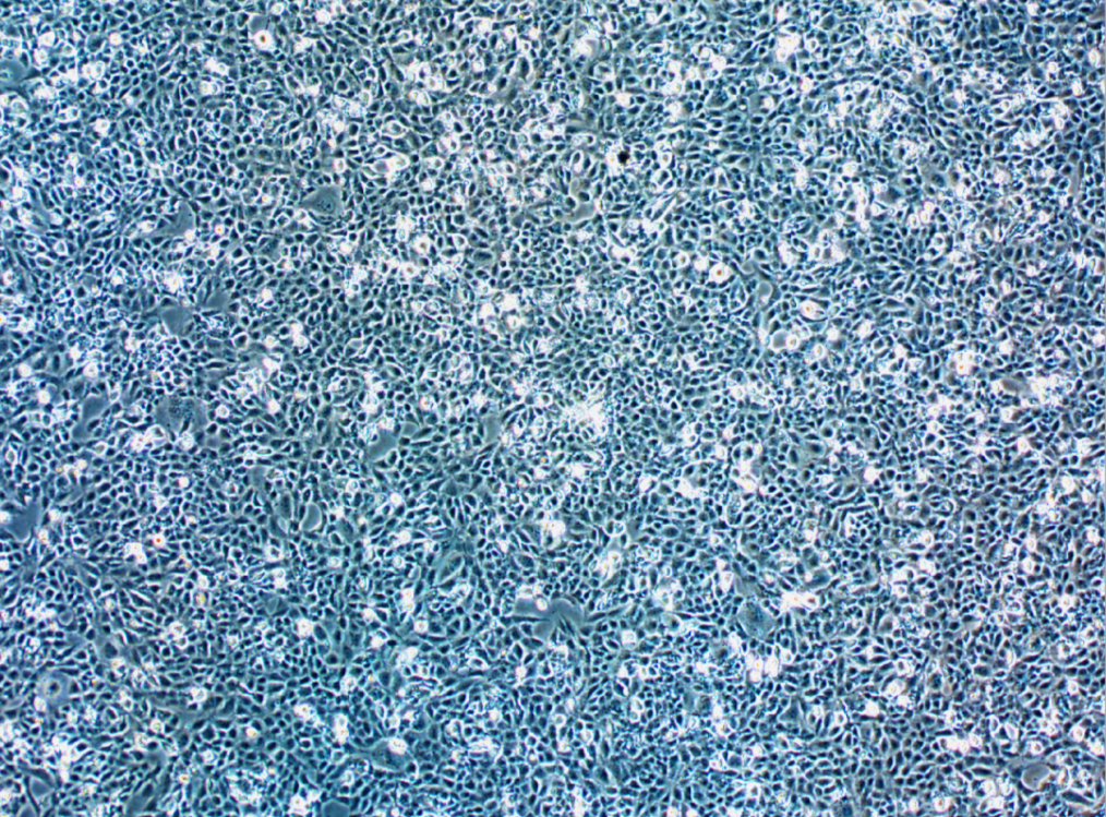 新型人類風濕性成纖維細胞樣滑膜細胞MH7A (STR鑒定正確)